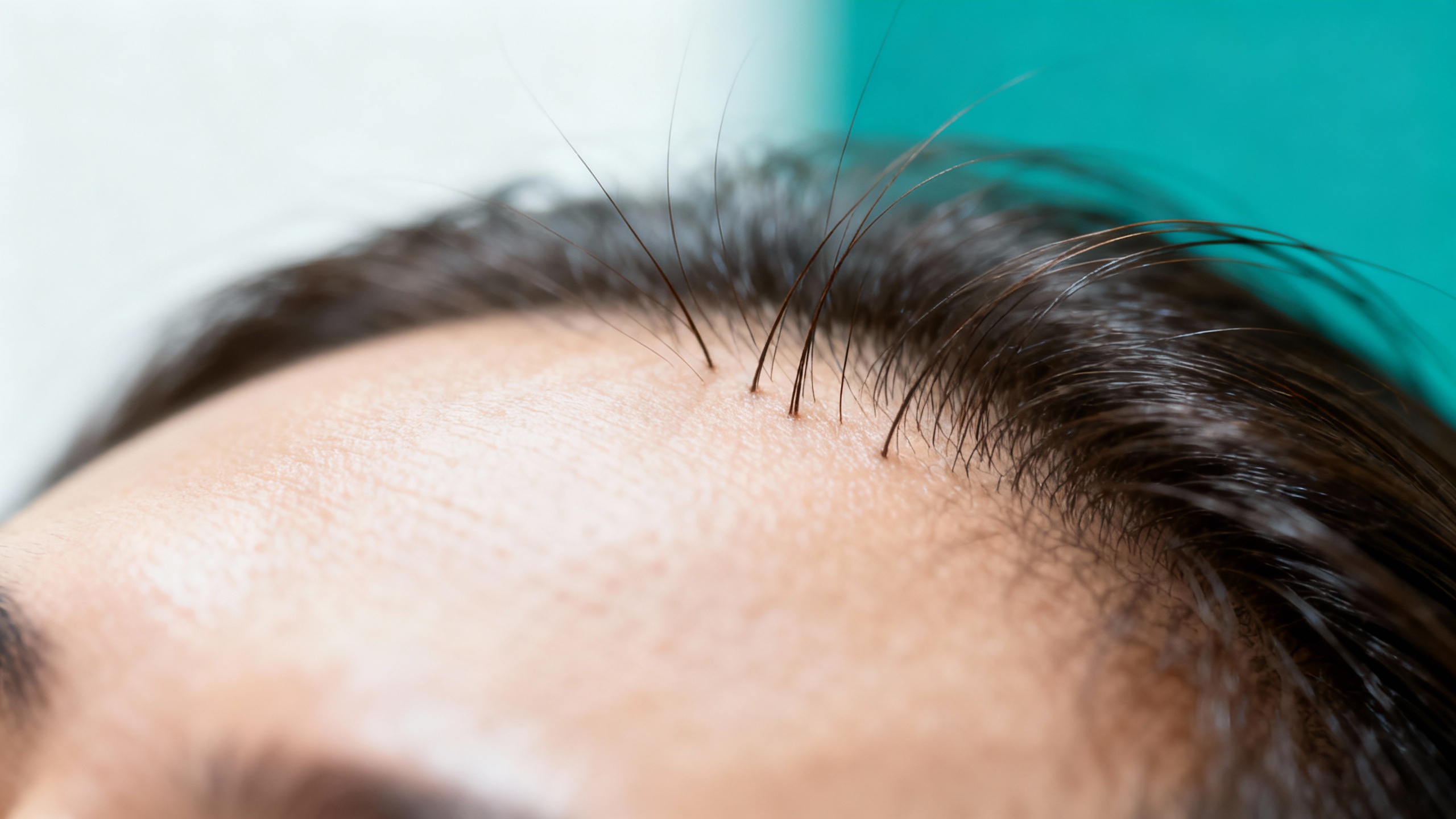 Featured image for The Ultimate Guide to Scalp Ringworm Treatment: Say Goodbye to Itching